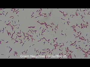 Gram Negative Rods under the Microscope at various magnification