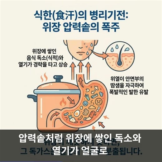 밥 먹을 때 얼굴 땀 원인, 식한증 증상 미각다한증 감별 및 위열 식적 한의원 치료