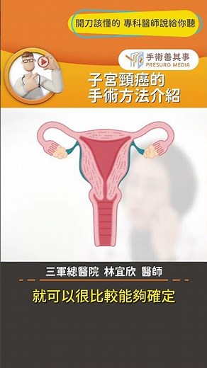 【子宮頸癌的手術方法介紹】#子宮頸癌 #椎狀切除 #手術 #手術善其事 #林宜欣醫師