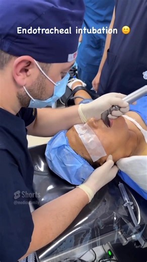Endotracheal intubation 🔑 #shorts #anaesthesiology #intubation #medicofamily