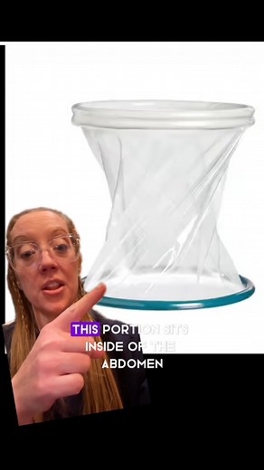 206K views · 1.5K reactions | The Alexis wound retractor is a device that is used during surgery to hold the wound open for surgeons to access the body cavity. They typically are included in the surgical count to avoid complications like this. #surgery #operatingroom #doctorexplains | Dr. Betsy Grunch - Ladyspinedoc | Facebook