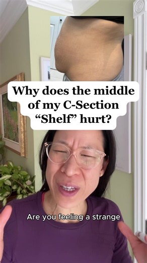 That pain above your C-section scar (right in the #csectionshelf / overhang) has NOTHING to do with your visible scar. 🤯 The mysterious deep tenderness when you lean against a counter. The soreness when you press gently on the shelf — even months after surgery. The sharp pain when you sneeze or sit up too fast. You're not imagining it. Here's what most hospitals don't explain: during a C-section, there isn't just one cut. There are four. And the one causing the most long-term pain — and contrib