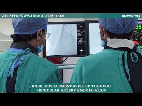 Knee Replacement Averted through Genicular Artery Embolisation | Dr. Sandeep Sharma | IRFACILITIES