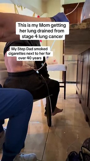 Smoking remains the leading cause of lung cancer worldwide. Each cigarette exposes the lungs to thousands of harmful chemicals that damage cells, weaken lung function, and dramatically increase cancer risk. The longer and heavier the smoking habit, the greater the danger — but quitting at any stage can significantly reduce the risk and improve overall health. Early awareness, regular check-ups, and smoking cessation are key steps to protecting your lungs and preventing long-term complications. H