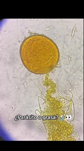 14K views · 91 reactions | A demon is born. This seems to be a fecal sample. With what I belive is an egg birthing qn unknown parasite. #parasites #microscopy | Parasite Purger | Facebook