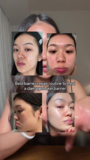 everything you need to know to repair a damaged skin barrier that’s giving you painful acne and dull skin. it’s less about the specific product and moreso the principles but I love these ones and they all have fantastic ingredients. Barrier repair is the first step to getting clear skin 🩵 @Sofie Pavitt Face @Experiment Beauty @House of Hur US @dieux @anua_global @epii_global @IUNIK #barrierepairroutine #barrierrepair #damagedskinbarrier #koreanskincareroutine #clearskin