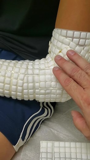 Cast arm with doctor skill 😳 #cast #doctorstrange #fyp #emotional #satisfying #castremoval #asmrtiktok #casthand