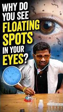 Why Do You See Floating Spots in Your Eyes? 👁️✨#Science #EyeFloaters #Vision #EyeHealth