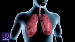 Formation of Lung Cancer | Lung Cancer Symptoms | #medicalanimation | Medical Animation Media