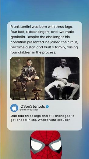 Unbelievable True Story: The Life of Frank Lentini, The Three-Legged Wonder