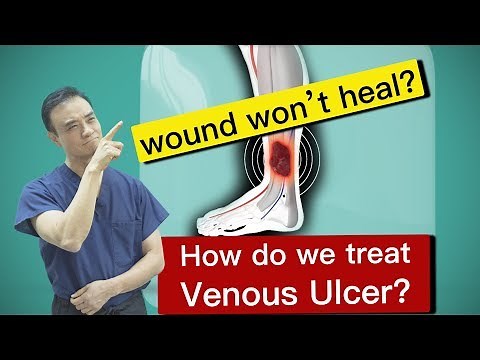 Wound Won't Heal? How do we treat Venous Ulcer?