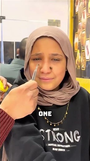 How Apitherapy Is Practiced😳 #shorts