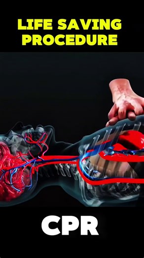 CPR LIFE SAVING PROCEDURE #Cardiopulmonaryresuscitation #CPRheroes #SaveLivesWithCPR #CPRawareness #LearnCPR #CPRtraining #CPRskills #CPRsaves #BeACPRpro #CPRcertified #CPRisImportant | Surgery Page