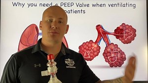 149K views · 75 reactions | Why we need to use a PEEP valve during...