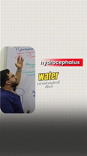 What's the hydrocephalus? #pathology