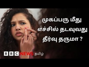 Pimple வருவதற்கு என்ன காரணம்? வியூகங்களும், அறிவியல் உண்மைகளும் | Explained