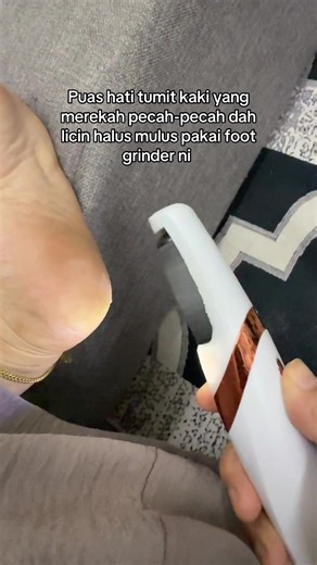 Achieve Smooth Heels with Foot Grinder Machine