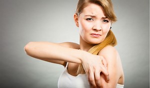 How do you cure a rash: 5 home remedies to treat common skin rashes