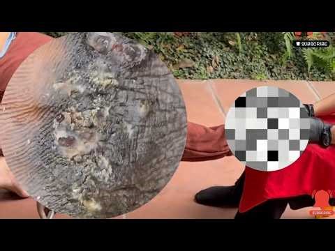 ⚡⚡ CARE REMOVAL JIGGER Shocking 1285