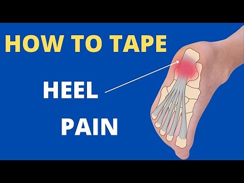 How to tape for heel pain / plantar fasciitis using the Low Dye technique