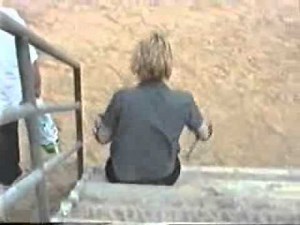 LHD Amputee at Xantem