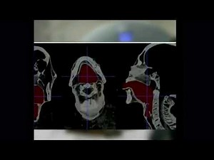 Egyptian mummy vocal cords AUGH meme