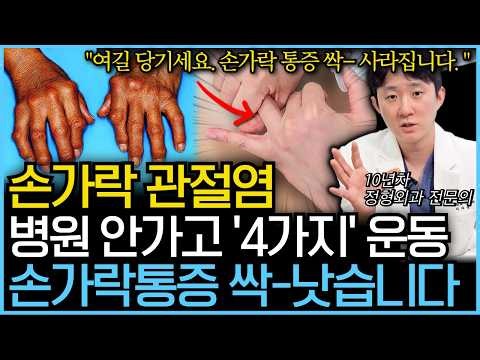 "Don't ignore finger pain." You can cure finger arthritis for free at home without a hospital vis...