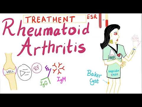 Rheumatoid Arthritis (Part 10): Management, Introduction