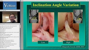 The Anatomy of the ACL