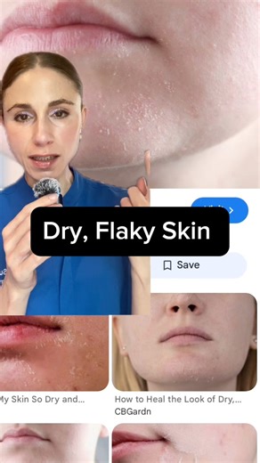 16K views · 166 reactions | Fix dry, flakey skin on the face. #dryskinrelief #dryskintips #dermatologist | Dr Dray | Facebook