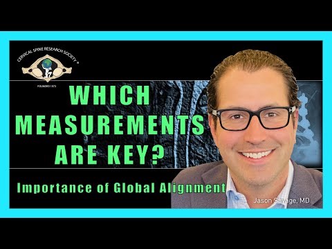 Importance of Global Alignment: Which Measurements are Key?