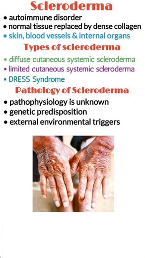 Scleroderma (systemic sclerosis), scleroderma types, scleroderma treatment, medical shorts #shorts