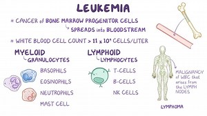 Video: Leukemia: Clinical - Video Explanation! | Osmosis | Osmosis