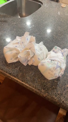 Managing AVPD Medication: Challenges and Complications