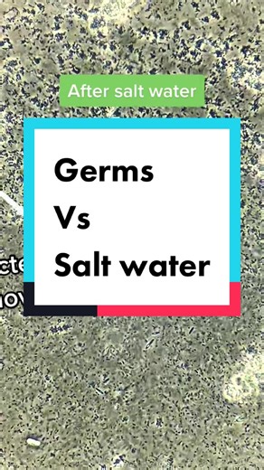 Replying to @dan_01071 SALT VERSUS BACTERIA UNDER THE MICROSCOPE #microscope #bacteria #salt #germs
