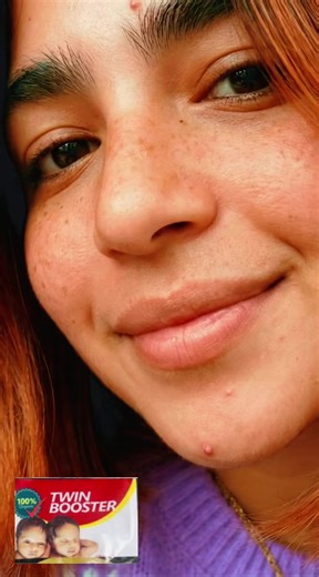 Exploring the Joys of Being Twins: Health Insights & Dance