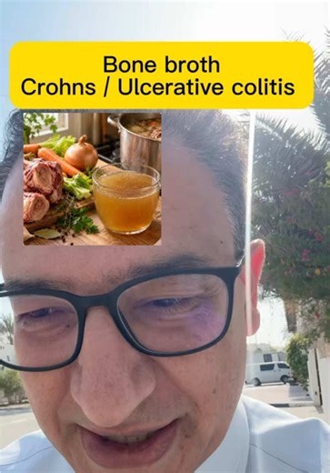 Bone broth seems to be very popular and for good reason. I do utilize it. Some useful ingredients, especially as a lowfibre option, but the claims sometimes stretch more than the evidence. Suggest discussing with your dietitian or Gastro if you plan changes to diet in IBD if you can. #BoneBroth #GutHealth #IBD