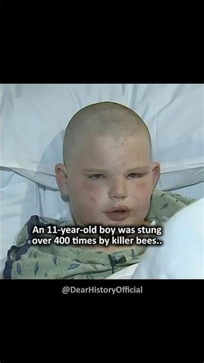 He survived 400 bee stings by thinking he was Vegeta #truestory #usa #dbz #bees #didyouknow