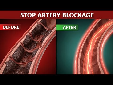 1 Best Meal to UNCLOG Your Arteries Fast (Backed by Science!)