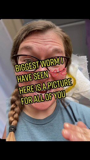 Giant Tapeworm Discovery: Largest Worm Ever Found!