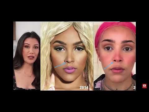 Lorry Hill - Doja Cat Plastic Surgery Analysis (REUPLOADED)