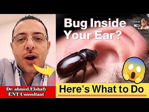 ⭐The Amazing Way Your Ears Fight Off Unwanted Insects! | ProHealthConsults