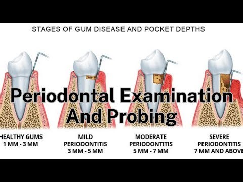 Periodontal Examination And Probing