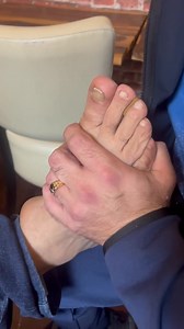 1M views · 9.4K reactions | Интересен случай ,изкълчване на глезена от преди пет години . | Manual Therapy Martin Markov and Cv | Facebook