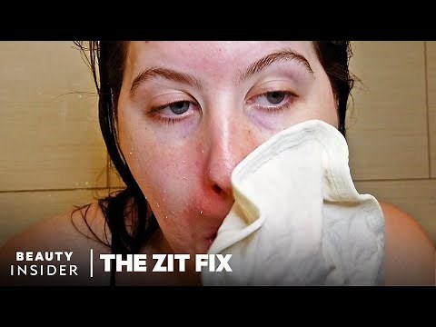 Exfoliating Mitt Scrubs Off Dead Skin In Seconds | The Zit Fix