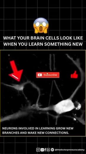 The Doctorpreneur Academy on Instagram: "Brain cells reshape themselves when making new connections! 🧠💫 with high temporal resolution, we can watch neurons search for other cells in real time. See how the growth cone moves and the long filopodia change shape — all captured with amazing nanolive imaging technology! 🌟 #neuroplasticity #medspiration #brainhealth #neuroscience #growthcone #innovation #cellbiology #scientificresearch #learning #brainconnections #imagingtechnology #neurofacts #mind