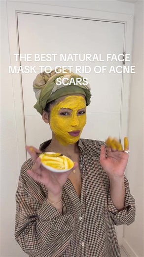 Natural Face Mask Recipe for Acne Scars