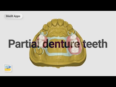 Designing teeth over the partial denture framework