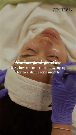 Glow comes from consistency | Microneedling at Zenderma