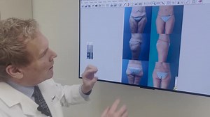 Surgery after Massive Weight Loss